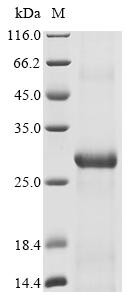 Recombinant Bat coronavirus HKU9 Spike glycoprotein (S), partial (CSB-BP385258BOV)