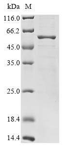 Recombinant Bat coronavirus HKU3 Nucleoprotein2 (N) (CSB-BP664686BFD)