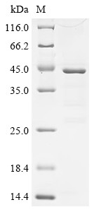 Recombinant Human C-C motif chemokine 21 (CCL21) (CSB-EP004785HUc0)