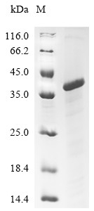 Recombinant Chicken Low-density lipoprotein receptor-related protein 1 (LRP1), partial (CSB-EP013091CH)