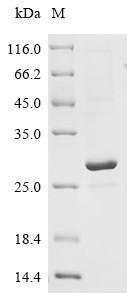 Recombinant Human cytomegalovirus Envelope glycoprotein H (gH), partial (CSB-EP319015HWVa0)