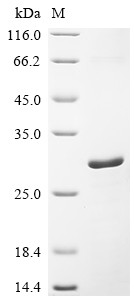 Recombinant Human Cell surface glycoprotein CD200 receptor 1 (CD200R1), partial (CSB-EP851547HU1)