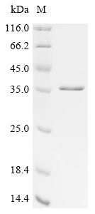Recombinant BK polyomavirus Large T antigen, partial, Biotinylated (CSB-EP360947BGY-B)