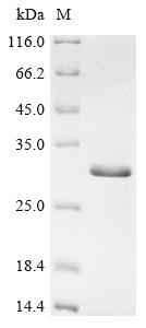 Recombinant Human Charged multivesicular body protein 2b (CHMP2B) (CSB-EP891990HUe1)