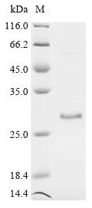 Recombinant Bovine Vascular endothelial growth factor A (VEGFA) (CSB-EP025833BO)