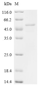 Recombinant Feline coronavirus Spike glycoprotein (S), Partial (CSB-EP319859FEJ1e0)