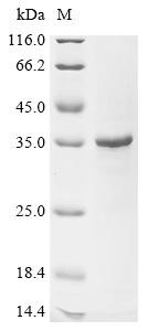 Recombinant Human Egl nine homolog 2 (EGLN2), Partial (CSB-EP007482HUa2)