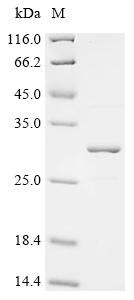 Recombinant Epstein-Barr virus Epstein-Barr nuclear antigen 1 (EBNA1), partial (CSB-EP627067EEZ)