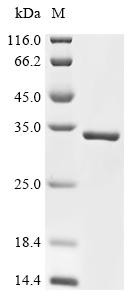 Recombinant Agrobacterium tumefaciens Single-strand DNA-binding protein (virE2), partial (CSB-EP363461AEZ)