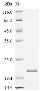 Recombinant Chicken Peptide YY-like (PYY) (CSB-EP019128CH)