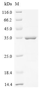 Recombinant Human C-X-C chemokine receptor type 4 (CXCR4), partial (CSB-EP006254HU1c0)