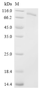 Recombinant Crimean-Congo hemorrhagic fever virus Envelopment polyprotein (GP), partial (CSB-EP810349CSC2)