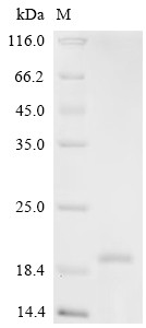 Recombinant Chicken Platelet derived growth factor subunit B (PDGF-B), partial (CSB-EP017709CH)