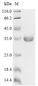 Recombinant Epstein-Barr virus Protein BMRF2 (BMRF2), partial (CSB-EP365872EFA)