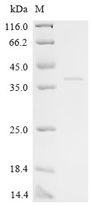 Recombinant Human FERM, ARHGEF and pleckstrin domain-containing protein 2 (FARP2), partial (CSB-EP008428HU)