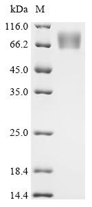 Recombinant Human cytomegalovirus Protein UL16 (UL16), partial (CSB-MP325853HWV)