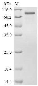 Recombinant Chicken Low-density lipoprotein receptor-related protein 1 (LRP1), partial (CSB-MP013091CH)