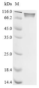 Recombinant African swine fever virus CD2 homolog, partial (CSB-MP803631AEJ)