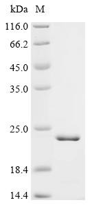 Recombinant Human Cyclic nucleotide-gated cation channel beta-1 (CNGB1), partial (CSB-EP623897HU)