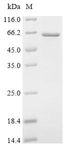 Recombinant Human Coronin-1A (CORO1A) (CSB-EP005813HU)