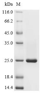 Recombinant Human Eukaryotic translation initiation factor 4E-binding protein 1 (EIF4EBP1) (CSB-EP623815HU)