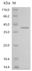 Recombinant Drosophila melanogaster Copia protein (GIP), partial (CSB-EP366106DLU)