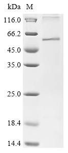 Recombinant Epstein-Barr virus Protein BDLF2 (BDLF2) (CSB-CF315180EEZ)