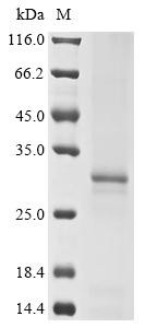 Recombinant Bat coronavirus 133/2005 Spike glycoprotein (S), partial (CSB-BP610383BFA)