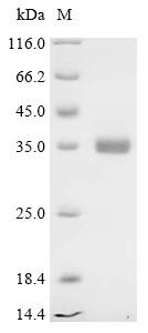 Recombinant Chicken Peptide YY-like (PYY) (CSB-YP019128CH)