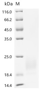 Recombinant Human Double homeobox protein 4 (DUX4), partial (CSB-YP890667HU1)