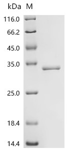 Recombinant Human Deoxyribonuclease-1-like 2 (DNASE1L2) (CSB-YP849794HU)