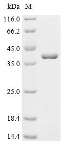 Recombinant Human Dead end protein homolog 1 (DND1) (CSB-EP809023HU)