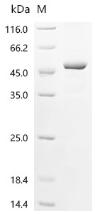 Recombinant Human F-box only protein 22 (FBXO22) (CSB-EP854115HUb0)