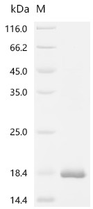 Recombinant Human C-C motif chemokine 5 (CCL5) (CSB-EP004800HUc7)