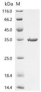 Recombinant Drosophila melanogaster Tyrosine-protein kinase hopscotch (hop), partial (CSB-EP631547DLU)
