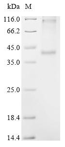 Recombinant Human C-X-C chemokine receptor type 3 (CXCR3) (CSB-CF006253HUd7)