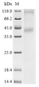 Recombinant Human fMet-Leu-Phe receptor (FPR1) (CSB-CF008854HU)