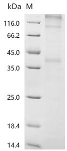 Recombinant Human C-C chemokine receptor type 7 (CCR7) (CSB-CF004846HUa0)