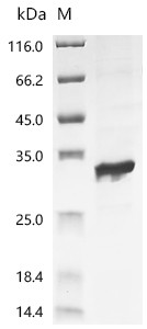 Recombinant Escherichia phage T7 T7 RNA polymerase (1), partial (CSB-EP018353EEBa2)