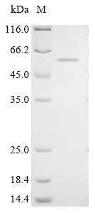 Recombinant Human Cysteine dioxygenase type 1 (CDO1) (CSB-EP621975HUf0)