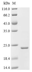 Recombinant Bacillus phage phi29 Single-stranded DNA-binding protein (5) (CSB-EP654323BBC)