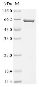 Recombinant Escherichia coli Periplasmic trehalase (treA) (CSB-EP319553ENV)