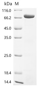 Recombinant Corynephage beta Diphtheria toxin, partial (CSB-EP360556CQR1c7)