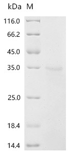Recombinant Human Deoxyribonuclease-1 (DNASE1) (CSB-YP007049HU)