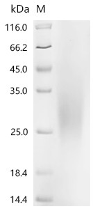 Recombinant Chicken Platelet derived growth factor subunit B (PDGF-B), partial (CSB-YP017709CH)