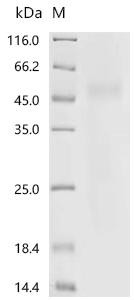 Recombinant Human Collagen alpha-1 (XVIII) chain (COL18A1), partial (CSB-YP005725HU4)