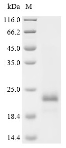 Recombinant Chlamydia pneumoniae Large cysteine-rich periplasmic protein OmcB(omcB), partial (CSB-BP326426DRZ)