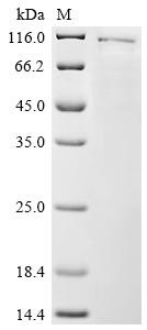 Recombinant Human DNA topoisomerase 1 (TOP1) (CSB-BP024056HU)