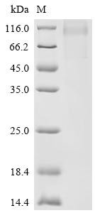 Recombinant Human Carboxypeptidase N subunit 2 (CPN2) (CSB-MP005899HU)