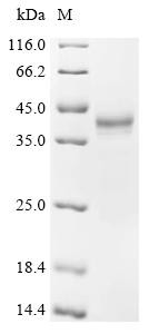 Recombinant Anguilla japonica Ventricular natriuretic peptide (vnp) (CSB-MP329334BZH)